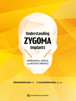 cover image of Understanding Zygoma Implants